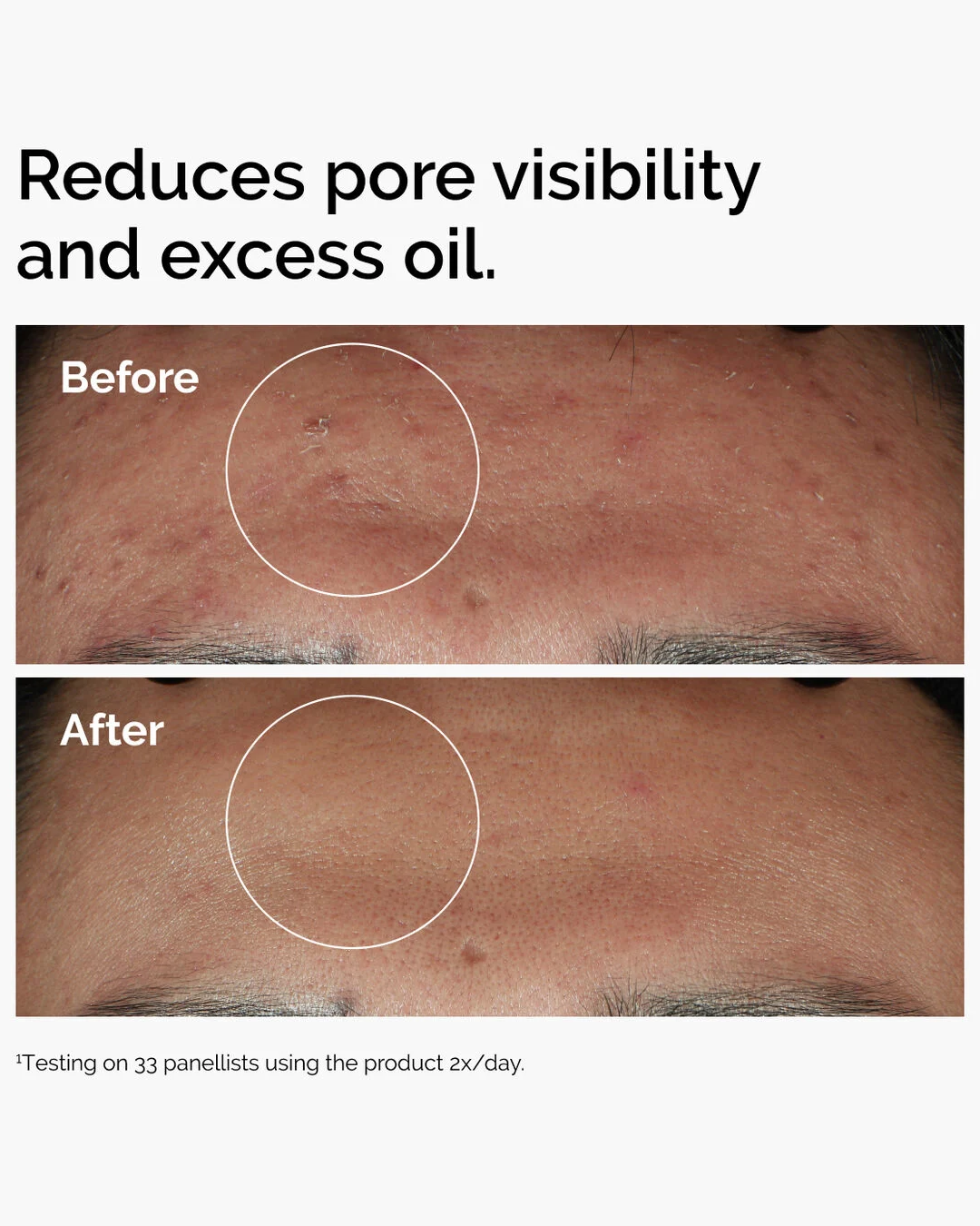 Niacinamide 10% + Zinc 1%